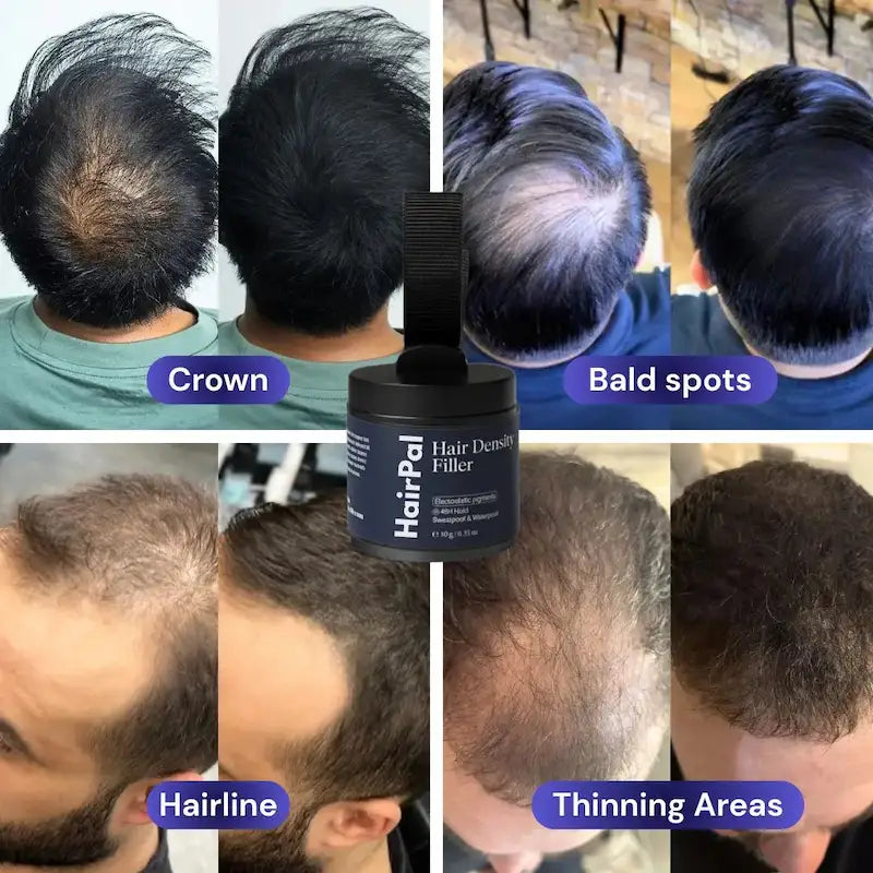 Hair Density Filler